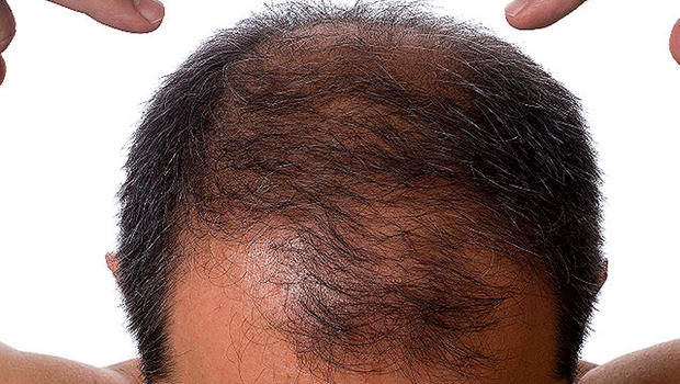 does zinc help regrow hair